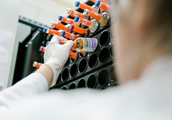 Effiziente-Diagnostik Für die Labordiagnostik und die Laboruntersuchungen werden Proben in entsprechende Behälter sortiert