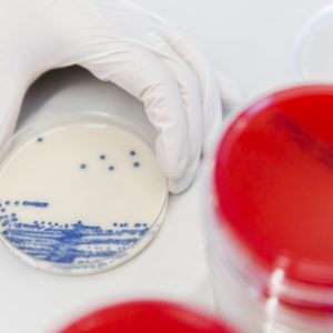 Eine Hand greift nach einer Bakterienkultur – Kulturwachstum ist Teil der Medizinischen Mikrobiologie und Infektionsdiagnostik