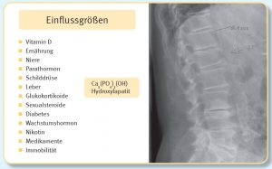 Einflussgrößen Vitamin D